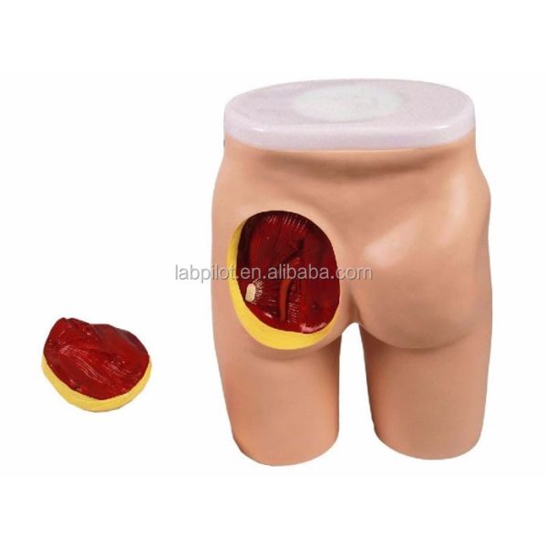 Comprehensive IM Injection Teaching Model for Gluteal Muscles and Anatomy Education