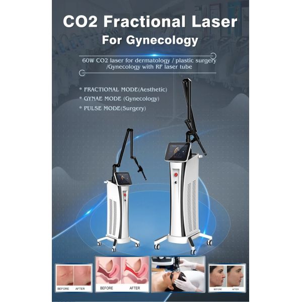 60 Вт фракционная обработка CO2 лазерная машина по омоложению кожи 10600nm