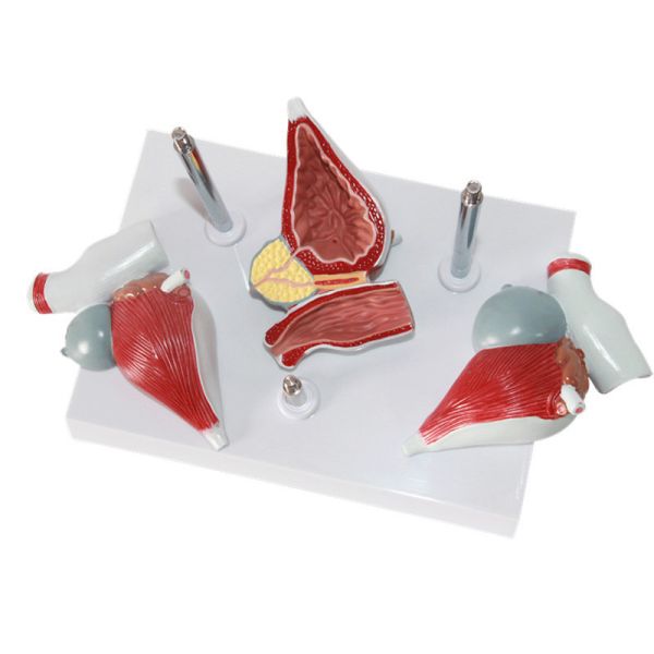 Human Anatomy PVC Simulation Human Pathology Prostate Model For Medical Educational