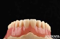 Good Elasticity Acrylic Denture Finish For Lightweight Personalized Customization And Customized Design