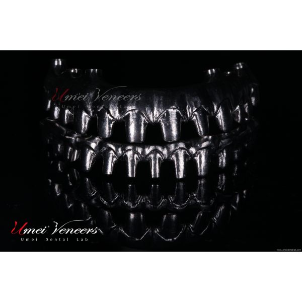 Robust Zirconia Malo Bridge