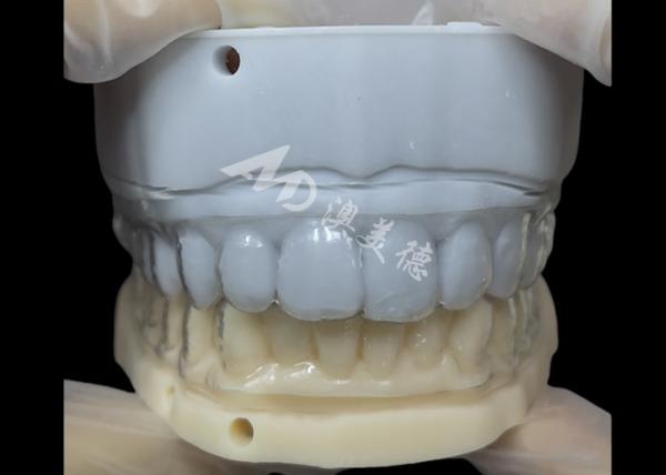 Appareils orthodontiques esthétiques Retenant invisible Correction simple et polyvalente