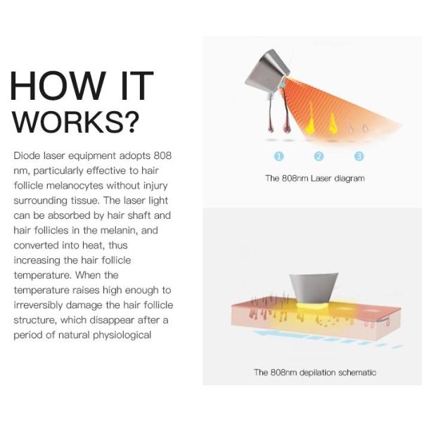 Машина ипл безболезненного удаления волос лазера диода 808 Нм профессиональная с утверждением КЭ/ИСО