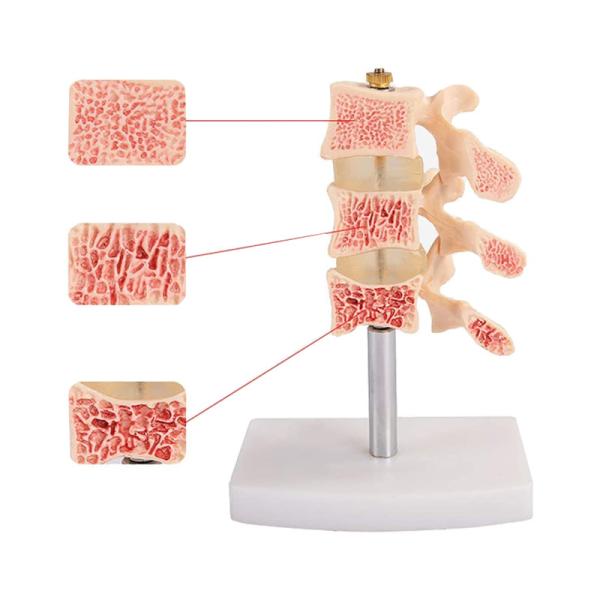 Hospital Education Osteoporosis 0.4kg Life Size Human Skeleton Model