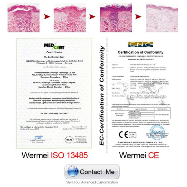 Beauty machine with 1550Nm fractional  Erbium Glass fiber Laser diode  for skin rejuvenation
