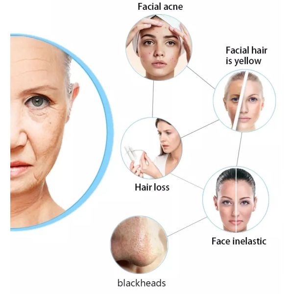 Затягивать кожи машины кислорода оборудования салона красоты дополнения кислорода лицевой