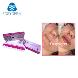Dermal Lip Fillers