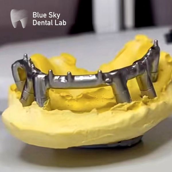 Implants dentaires Blue Sky Bar de titane argenté Pour les implants dentaires