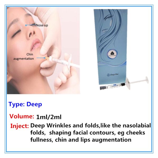 CE HA Dermal Filler Hyaluronic Acid Fosyderm 1ml Lip Injections