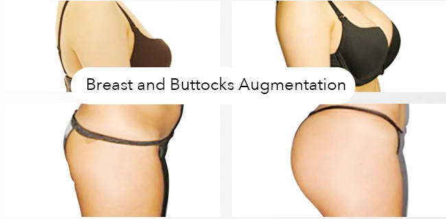 10ml Hyaluronic Acid Breast Enlargement Filler Injection