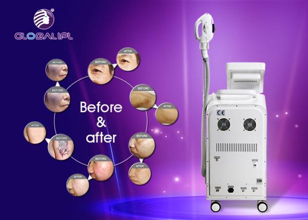 Poder multifuncional de Machiine 2500W da beleza da remoção do cabelo/tatuagem do laser do ND YAG da luz de E/IPL RF