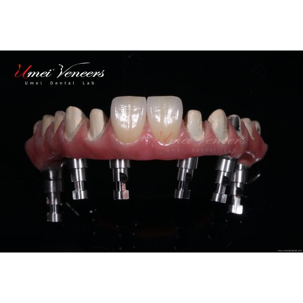 Good biocompatibility zirconia bridge