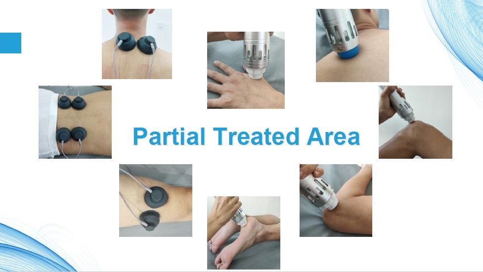 Ультразвук ручки оборудования терапией ударной волны роста мышцы одиночный