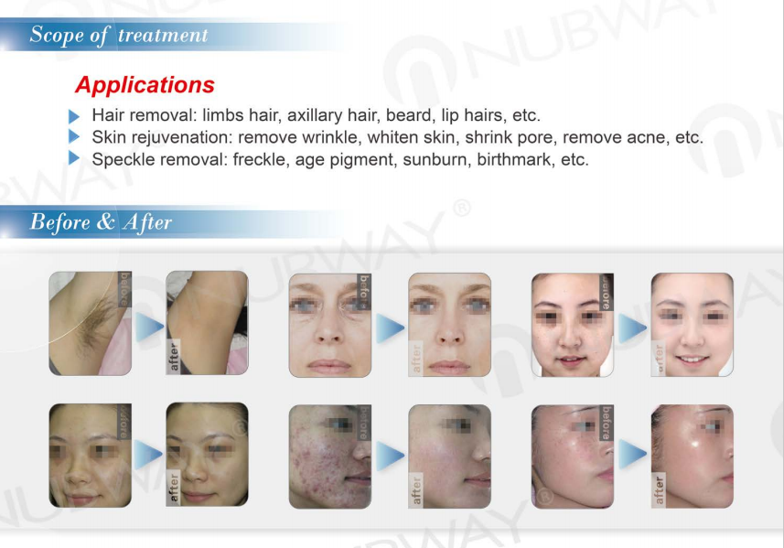 multi-functional IPL beauty hair removal machine