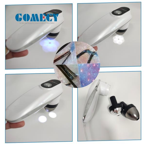 2025 AI Skin Analyzer 4 Wavelength Diode Laser Hair Removal Machine 755nm 808nm 940nm 1064nm Painless Permanent