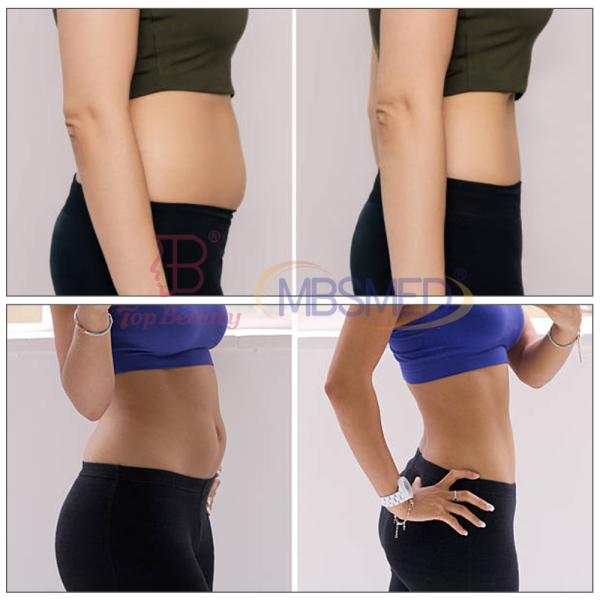 Cet Ret Monopolar Rf Skin Tightening Machine With Touch Screen