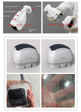 HIFU Liposonix 2 in 1 Beauty Machine for face lifting and shaping / slimming