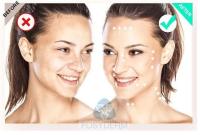 Filorga  135ha 5*3ml Mesoterapia facial por injecção para melhorar a qualidade da pele