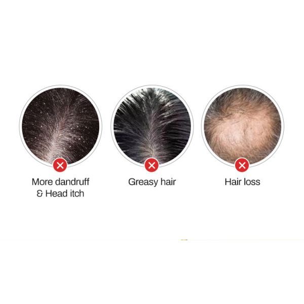 Best Selling Hair Growth Shampoo for Thinning Hair Loss for Women and Men Thicker Longer Hair