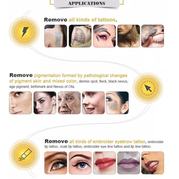 3 в 1 к переключил машину татуировки лазера НД Яг размер места 2 до 8мм