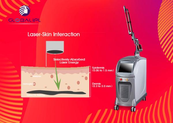 Skin Rejuvenation Nd Yag Laser Tatoo Removal Machine 1064nm 532nm ISO13485
