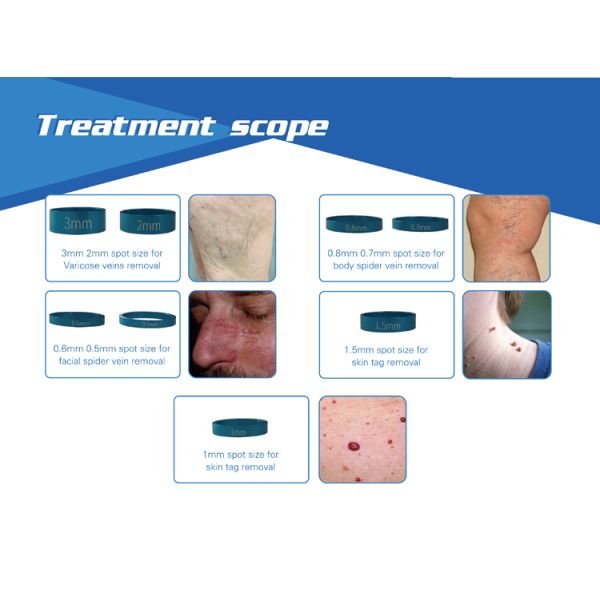 Professional treatment 980nm diode laser vascular removal machine NBW-980