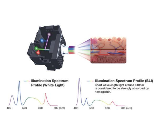 Système d'imagerie endoscopique Fujifilm ELUXEO Lumière Blanche Supérieure