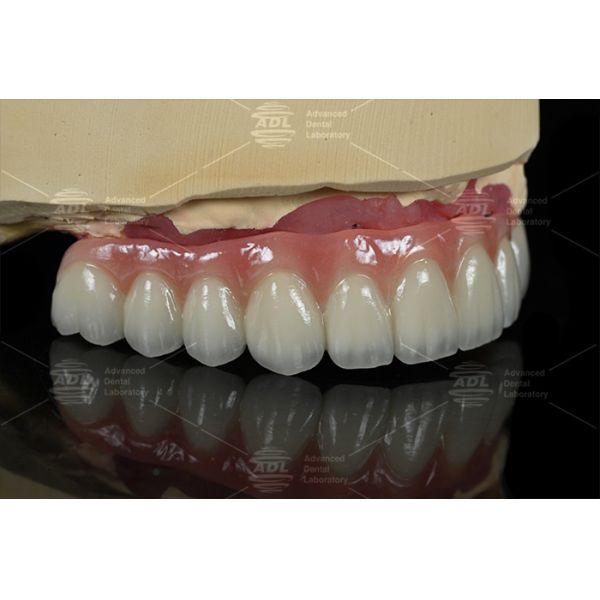 Hypoallergenic PFZ dental solutions tailored to meet diverse clinical and dental lab needs services ensuring precision