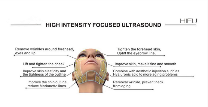 Женская частная машина заботы 3Д ХИФУ, влагалищная затягивая кожа затягивая машину