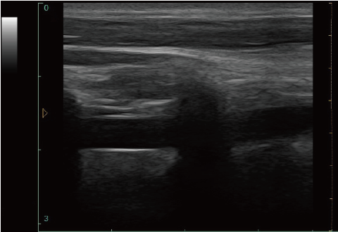 Блок развертки ультразвука ноутбука ультразвука СИД 12 дюймов диагностический медицинский с одним зондом подключает программное обеспечение ветеринара доступное