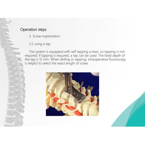 Spine Anterior Cervical Plate Titanium Cervical Plate Implant Orthopedic Surgery CE Certification