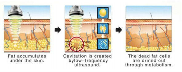 650nm - 550nm Cryolipolysis уменьшая машину для формировать тела/кожа Tigtening