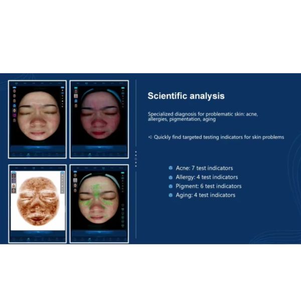 AI System Detection Skin Analyzer With Hair Follicle Detection