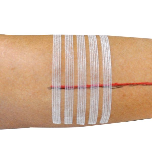 Sterile  Wound Closure Strip First Aid Kit Supplies And Equipment For Camping