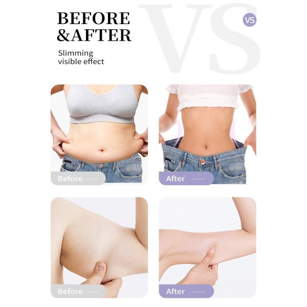 Non-woven Fabric Fat Burning Stickers for Losing Weight and Reducing Cellulite on Body Belly Waist Legs Thigh 160*53mm