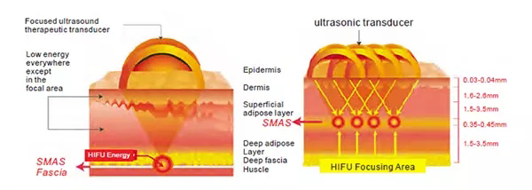 Skin Salon HIFU Beauty Machine , Body Shaping HIFU Ultrasound Machine Painless
