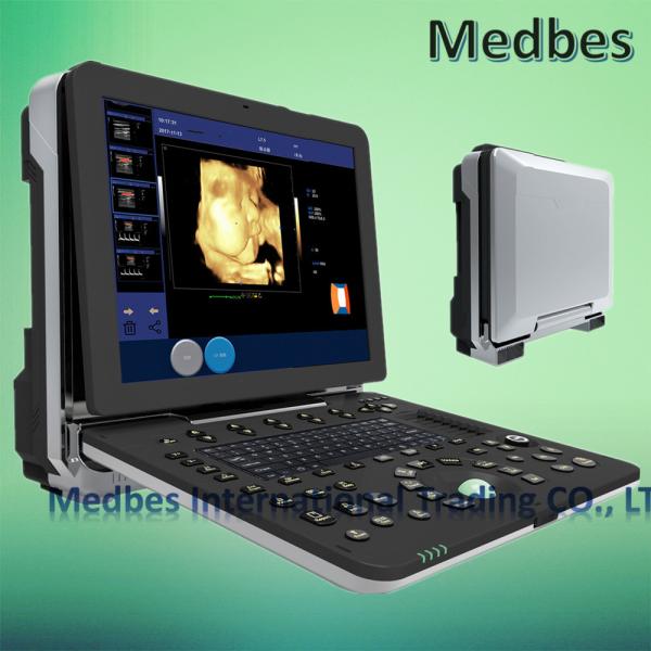 Windows 4D Portable  Color Doppler Ultrasound Scanner  Ultrasound System Scanner