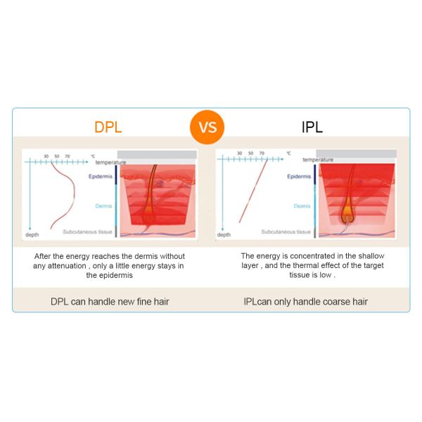 DPL Hot Sale Multifunctional Dpl+Elight+Sr Hr +Ipl + Rf Hair Removal Vascular Removal Ipl Dpl Skin Rejuvenation Machine