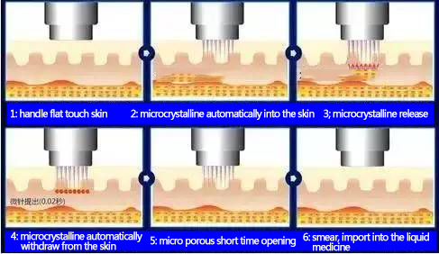 Face Lifting Portable Rf Fractional Microneedling Machine For Acne Scar Removal