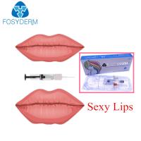 Enchimento cutâneo ácido hialurónico de Fosyderm para a plenitude dos bordos linha profunda de 2 Ml
