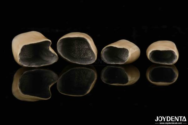 Premium Gold and Palladium Alloy Dental Crowns for Enhanced Durability