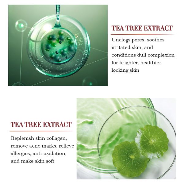 перевозчик прыща угорь ремонта сыворотки стороны сути сброса дерева чая OEM 1oz/30ml органический