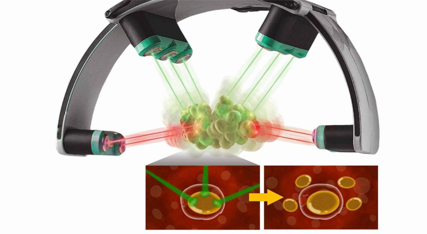 Luxmaster Vacuum Lipo Máquina de adelgazamiento láser para la escultura del cuerpo células grasas de destino con 532nm luz verde y terapia de rodillos