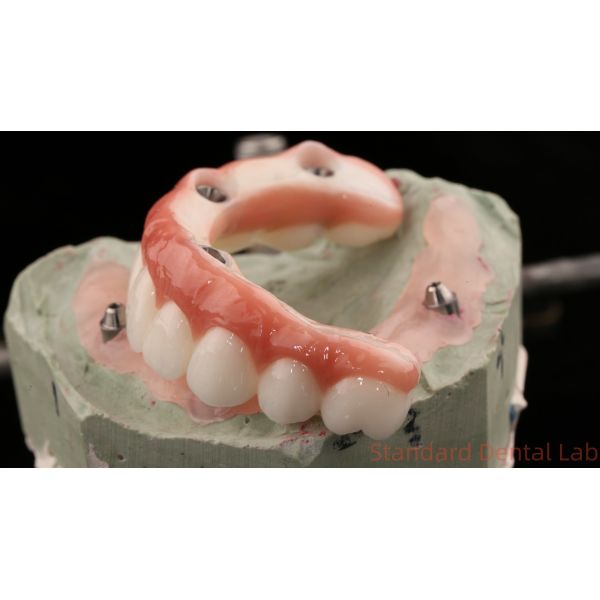 Высококачественная зубная цирконовая корона и All On Four Six Implant Full Arch / Китайская стоматологическая лаборатория