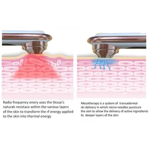 Забеливать машину ухода за лицом радиочастоты заботы кожи 7500ХЗ
