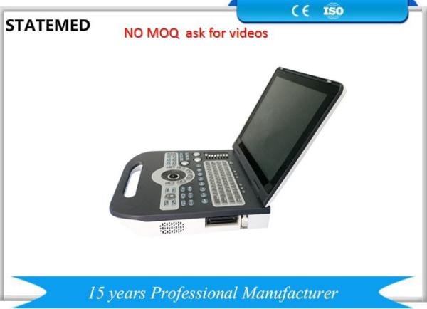 4d Image Technology Color Doppler Ultrasound Scanner For Pregnancy Ultrasound