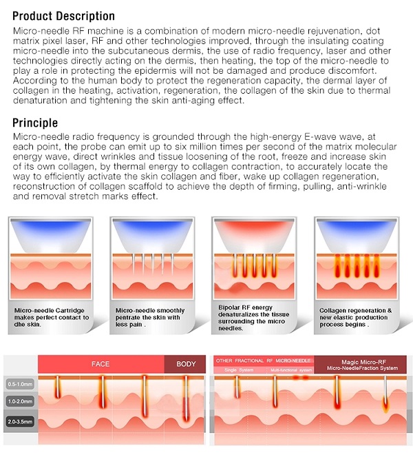 Машина RF удаления Марк частичная, 2 в 1 приборе RF Microneedling с холодным молотком