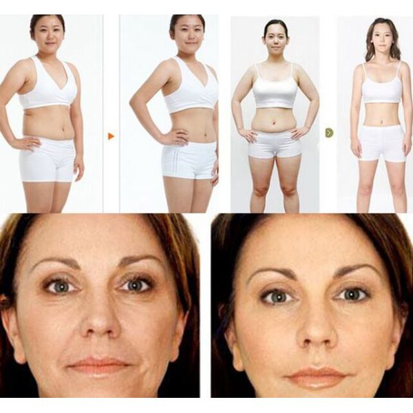 Body Contouring / Weight Loss Lipo Laser Treatment Radio Frequency Machine