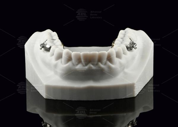 Lingual Arch Biliteral Space Maintainer Stainless Steel Teeth Space Maintainers