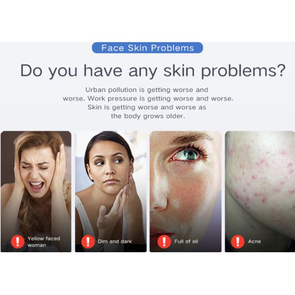 Красное и голубое угорь 640nm 415nm машины терапией света СИД